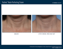 Load image into Gallery viewer, Techno Neck Perfecting Cream