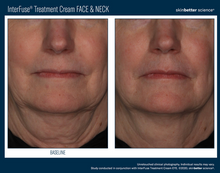 Load image into Gallery viewer, InterFuse Treatment Cream / FACE &amp; NECK
