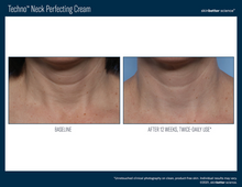 Load image into Gallery viewer, Techno Neck Perfecting Cream
